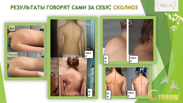  СЕАНС БИОЭНЕРГОМАССАЖА FOHOW. 2